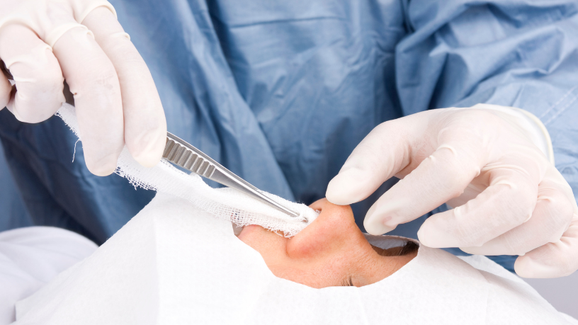 Confiança renovada com a transformação estética guiada por Dr. Gilberson Wanderley Silva.