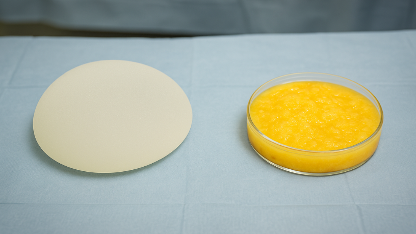 Para Milton Seigi Hayashi, prótese de glúteo x enxerto de gordura oferecem benefícios distintos para projeção e naturalidade.